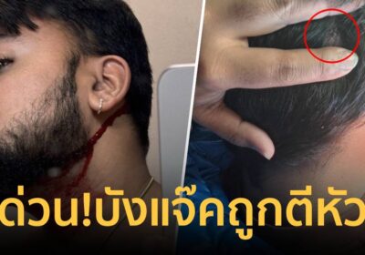 ด่วน! บังแจ๊ค ถูกตีศีรษะ และถูกแย่งโทรศัพท์มือถือไอโฟนไป